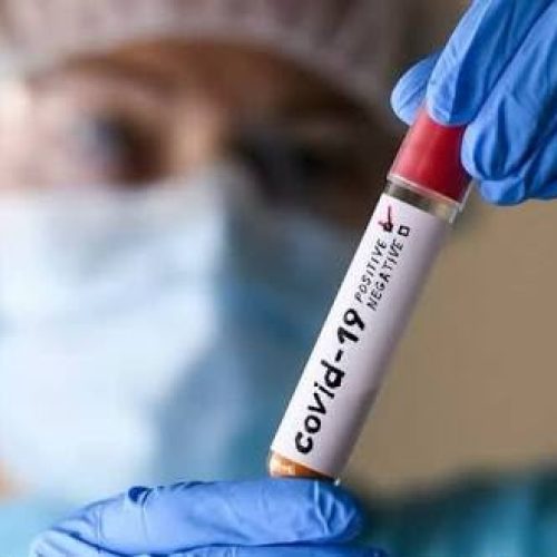 Novas investigações sobre a origem da Covid-19 reacendem debate nos EUA e no Brasil